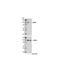 Cell Signaling Rap80 (D1t6q) Rabbit mAb