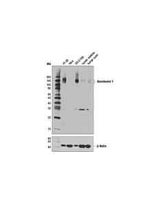 Cell Signaling DOG1/Anoctamin 1 (D1M9Q) Rabbit mAb 20 uL