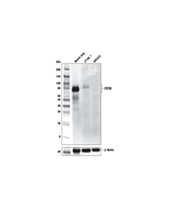 Cell Signaling Cd39/Ntpdase 1 (E2x6b) Xp Rabbit mAb (Mouse Specific)