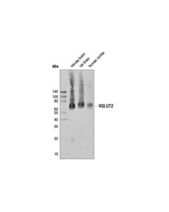 Cell Signaling Vglut2 (D4e3u) Rabbit mAb