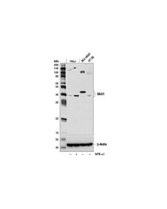 Cell Signaling OAS1 (D1W3A) Rabbit mAb 20 uL