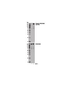 Cell Signaling Phospho-Her3/Erbb3 (Tyr1328) (E1j1t) Rabbit mAb