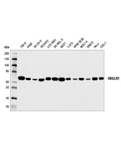 Cell Signaling Ubqln1 (D3t7f) Rabbit mAb