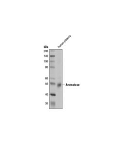 Cell Signaling Aromatase (D5q2y) Rabbit mAb