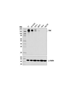 Cell Signaling Ret (E1n8x) Xp<LT/>Sup&Gt;®<LT/>/Sup&Gt; Rabbit mAb