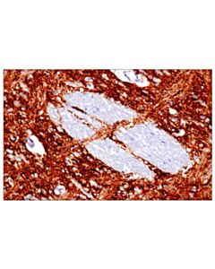 Cell Signaling Synaptotagmin-1 (D33b7) Rabbit mAb