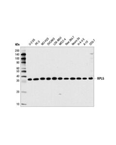 Cell Signaling Rpl5 Antibody