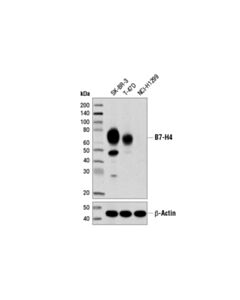 Cell Signaling B7-H4 (D1m8i) Xp Rabbit mAb