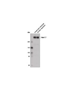 Cell Signaling Nav1.7 Antibody