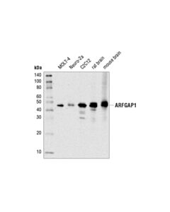 Cell Signaling Arfgap1 (D4c2m) Rabbit mAb