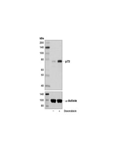 Cell Signaling P73 (D3g10) Rabbit mAb
