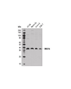 Cell Signaling Ing1b (D3d5z) Rabbit mAb