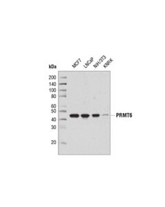 Cell Signaling Prmt6 (D5a2n) Rabbit mAb