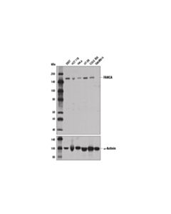 Cell Signaling Fanca (D1l2z) Rabbit mAb