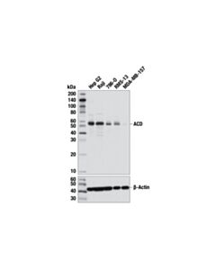 Cell Signaling Tpp1 (D4e2r) Rabbit mAb