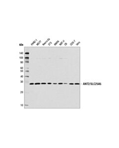 Cell Signaling Ant2/Slc25a5 (E2b9d) Rabbit mAb