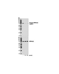 Cell Signaling Phospho-Alk (Tyr1507) (D6f1v) Rabbit mAb