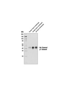 Cell Signaling Na Channel beta1 Subunit (D9T5B) Rabbit mAb 20 uL