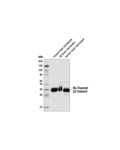 Cell Signaling Na Channel beta2 Subunit (D1S8E) Rabbit mAb 20 uL