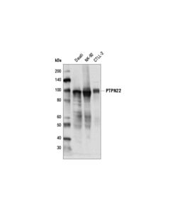 Cell Signaling Ptpn22 (D6d1h) Rabbit mAb