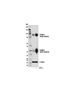 Cell Signaling Vcam-1 Antibody (Rodent Specific)