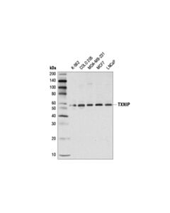 Cell Signaling Txnip (D5f3e) Rabbit mAb