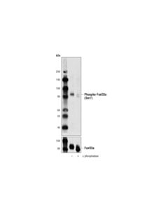 Cell Signaling Phospho-Foxo3a (Ser7) Antibody
