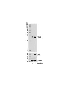 Cell Signaling Tigar (D3f4a) Rabbit mAb