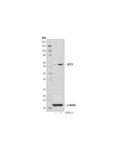 Cell Signaling IFIT1 (D2X9Z) Rabbit mAb 20 uL