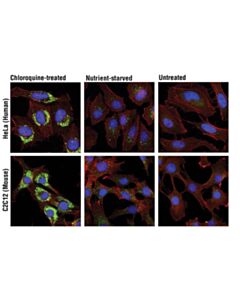 Cell Signaling Chloroquine