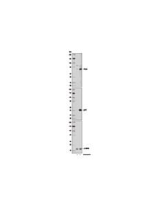 Cell Signaling Plk2 (D5r2b) Rabbit mAb