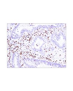 Cell Signaling Ikaros (D6n9y) Rabbit mAb