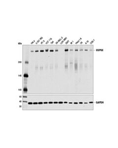 Cell Signaling Usp9x (D4y7w) Rabbit mAb
