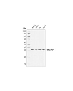 Cell Signaling SF2/ASF (D1N3S) Rabbit mAb 20 uL