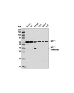 Cell Signaling MST1 (D8B9Q) Rabbit mAb 20 uL