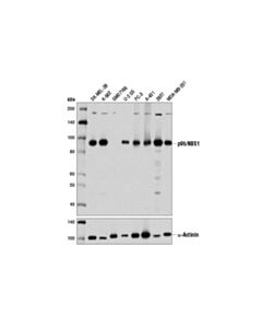 Cell Signaling P95/Nbs1 (D6j5i) Rabbit mAb