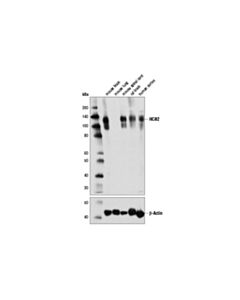Cell Signaling Hcn2 (D1c6i) Rabbit mAb