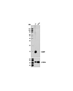 Cell Signaling Cgrp (D5r8f) Rabbit mAb