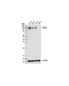 Cell Signaling Ephb4 (D1c7n) Rabbit mAb
