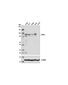 Cell Signaling Ifi16 (D8b5t) Rabbit mAb