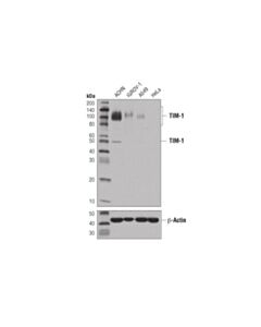 Cell Signaling Tim-1 (E1r9n) Rabbit mAb