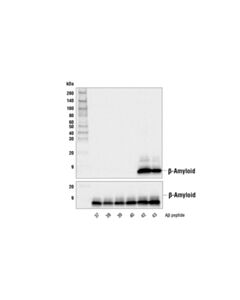 Cell Signaling Beta-Amyloid (1-42) (D9a3a) Rabbit mAb