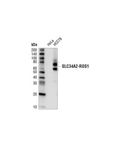 Cell Signaling Ros1 (D4d6 ) Rabbit mAb (Hrp Conjugate)