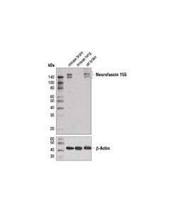 Cell Signaling Neurofascin 155 (D7b6o) Rabbit mAb