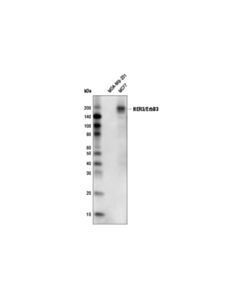 Cell Signaling Her3/Erbb3 (D22c5) Xp Rabbit mAb (Hrp Conjugate)
