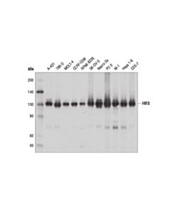 Cell Signaling HRS (D7T5N) Rabbit mAb 20 uL