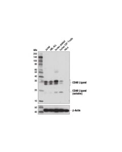 Cell Signaling Cd40 Ligand (D5j9y) Rabbit mAb