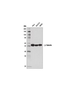 Cell Signaling Beta-Tubulin (D2n5g) Rabbit mAb