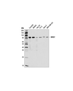 Cell Signaling BRD7 (D9K2T) Rabbit mAb 20 uL