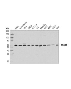 Cell Signaling Trxr1 (D1t3d) Rabbit mAb
